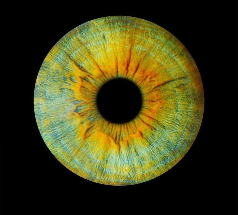 Metz: Your professional iris photography with framed print